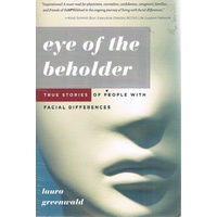 Eye Of The Beholder. True Stories Of People With Facial Differences