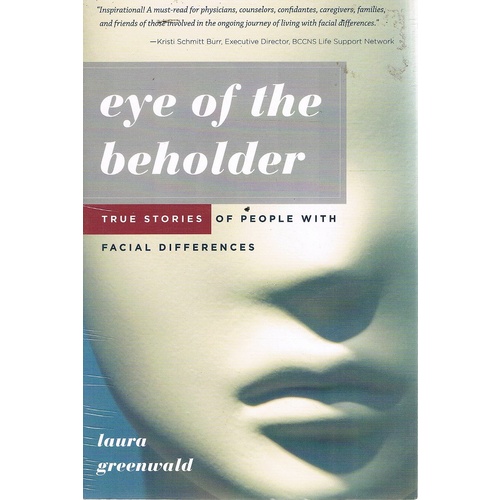 Eye Of The Beholder. True Stories Of People With Facial Differences