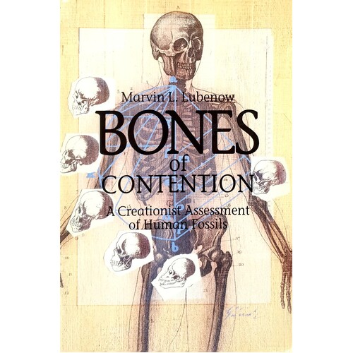 Bones Of Contention